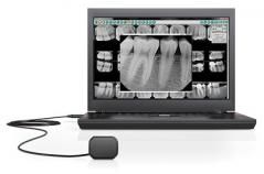 Dexis Digital Dental X-rays