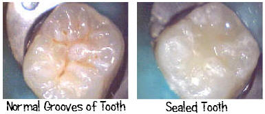 Sealant_Before_After